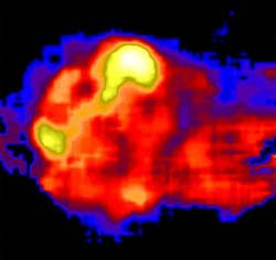 Vela supernova remanant